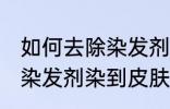 如何去除染发剂染在皮肤上的颜色 被染发剂染到皮肤如何处理